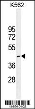 CRFR1 Antibody (Q103)