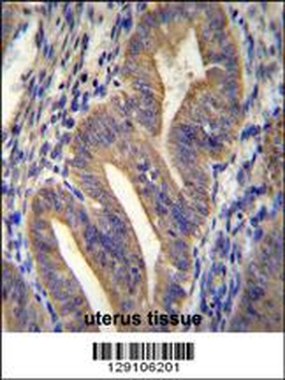 METTL10 Antibody (N-term)