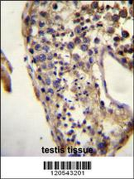 ECAT1 Antibody (N-term)