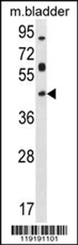 HOXD13 Antibody (Center)