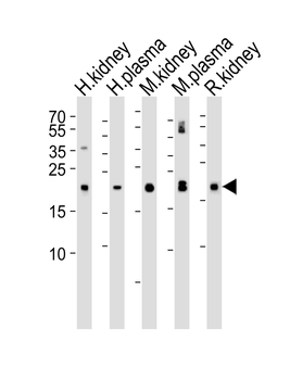 GPX3 Antibody (Center)