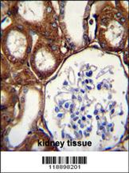 GPX3 Antibody (Center)