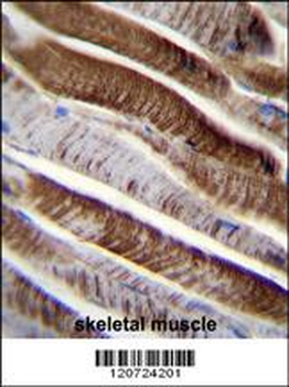 ETFA Antibody (C-term)