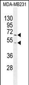 FUT8 Antibody (Center)
