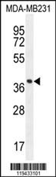 FOXA2 Antibody (Center)