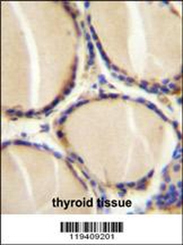 CALCA Antibody (Center)