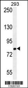 GGCX Antibody (Center)