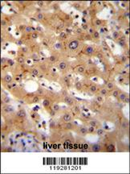 GGCX Antibody (Center)