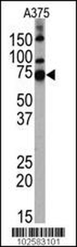 HDAC10 Antibody (N-term)
