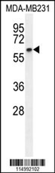 CCNB1 Antibody (C-term)