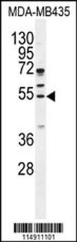 CCNB1 Antibody (Center)