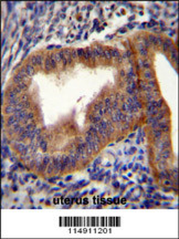 CCNB1 Antibody (Center)