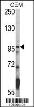 HDAC7 Antibody (C-term)