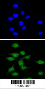 AIRE Antibody (Center)