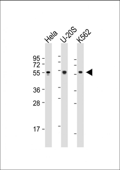 AIRE Antibody (Center)