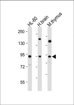 ENASE Antibody (Center)