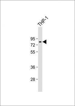 TTC39B Antibody (C-term)