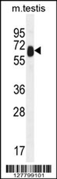 TTC39B Antibody (C-term)