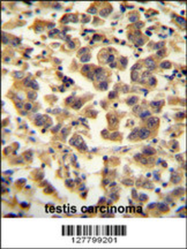 TTC39B Antibody (C-term)