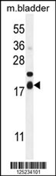 F162A Antibody (C-term)