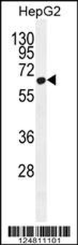 ZC12A Antibody (Center)