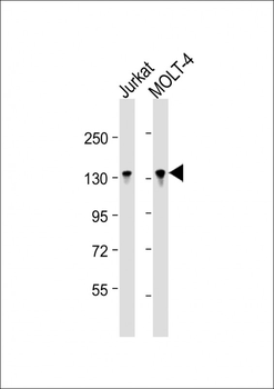 BCL11B Antibody (Center)