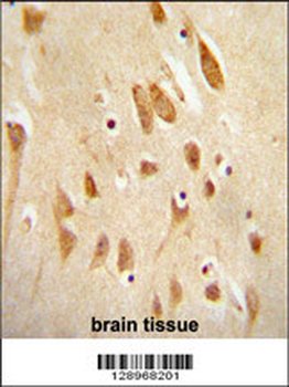 MAPK8 Antibody (T183/Y185)