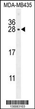 CSH1 Antibody (C-term)