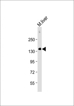 M CD31 Antibody (C-term)