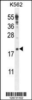 IQCJ Antibody (C-term)