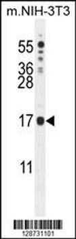 IQCJ Antibody (C-term)