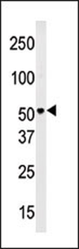PMAT(Slc29a4) Antibody (N-term)