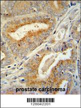 BCORL1 Antibody (N-term)