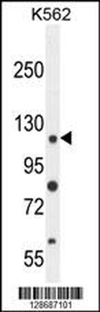 ANR52 Antibody (N-term)