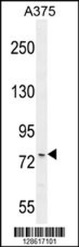ANR44 Antibody (Center)