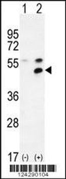 MPP1 Antibody (Center)