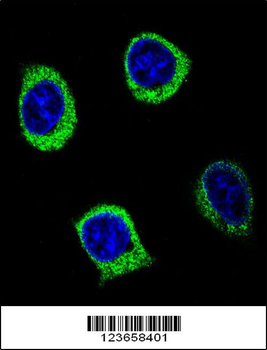 AMY2B Antibody (N-term)