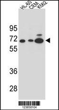 AMY2B Antibody (N-term)