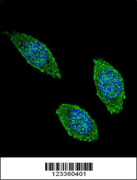 CSF2 Antibody (Center)