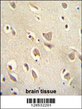 MCHR1 Antibody (C-term)