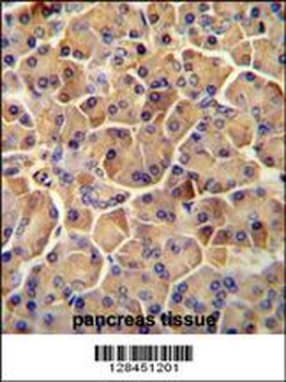 SEL1L Antibody (Center)