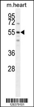 SPATC1 Antibody (N-term)