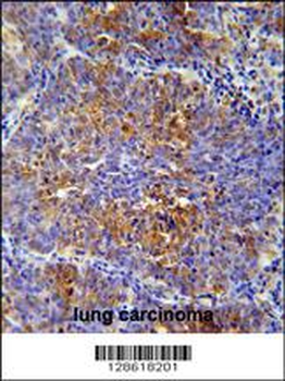 MCAF2 Antibody (Center)