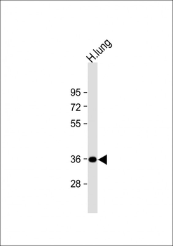 GRINA Antibody (Center)