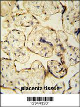 CLIC6 Antibody (Center)
