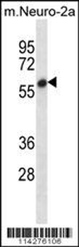 SMYD2 Antibody (N-term)
