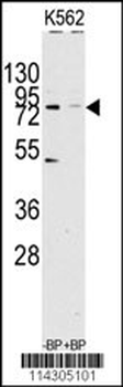JHDM1a/FBXL11 Antibody (C-term)