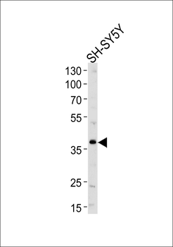 SERPINI1 Antibody (N-term)