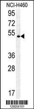 DENND1B Antibody (N-term)