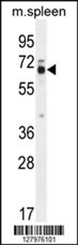 LMOD2 Antibody (N-term)